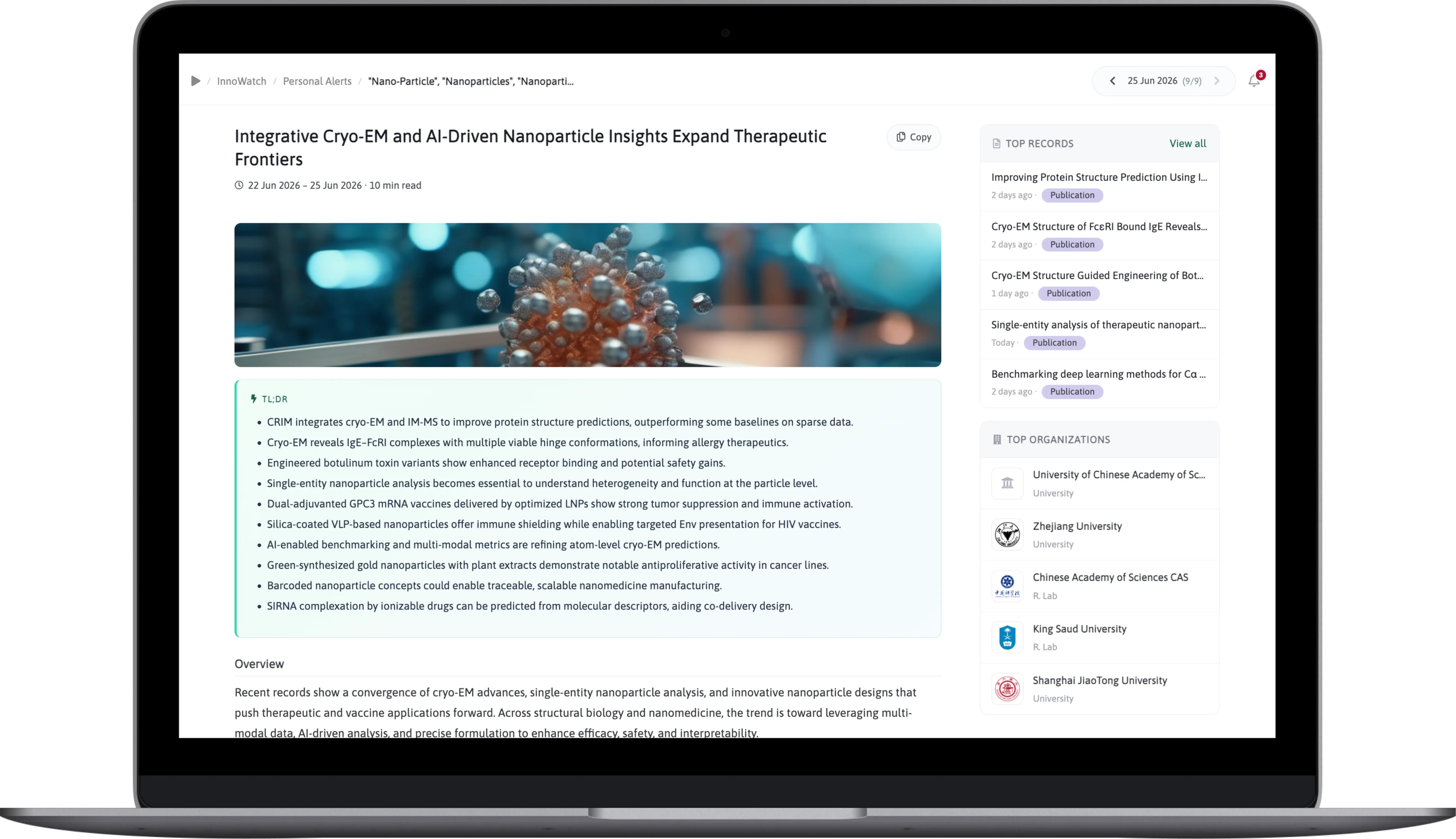 InnoWatch product preview